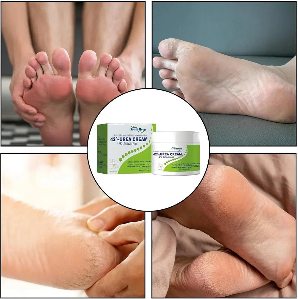 South Moon - 42% Urea Cream + 2% Salicylic Acid (Original) - mirenas.shop