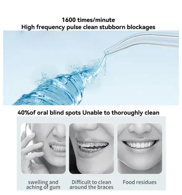 Oral Irrigator – Find Your Beauty - mirenas.shop